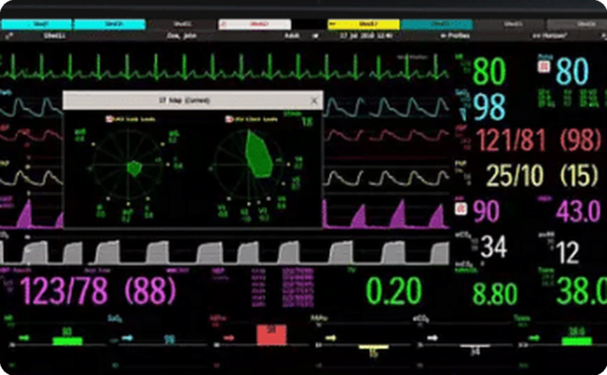 Integrated ECG, arterial blood pressure, cerebral NIRS, oxygen saturation, and respiratory waveforms