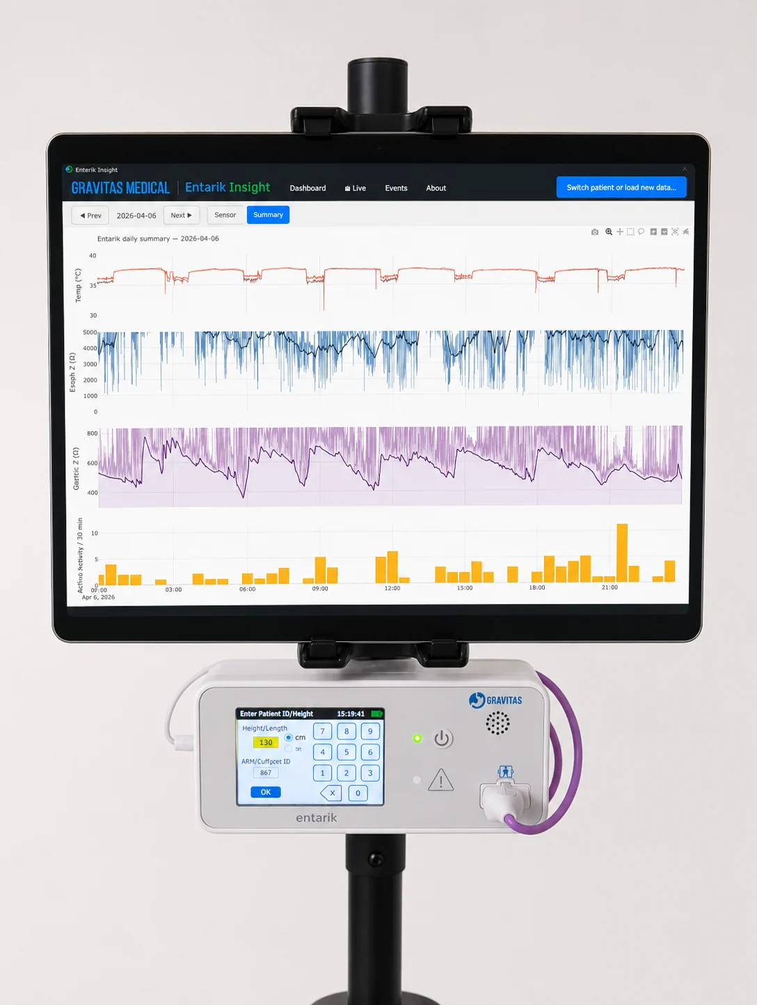Smart enteral sensing monitor and signal dashboard